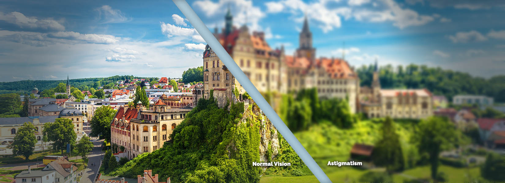 Astigmatism Treatment in Northwest El Paso